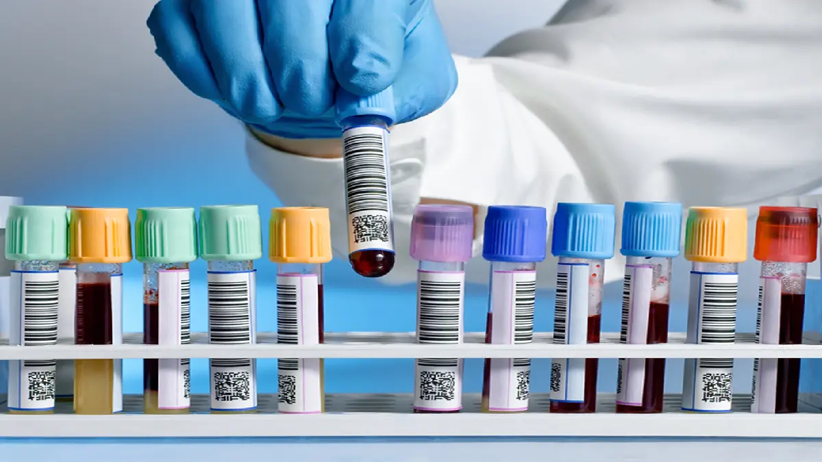 Different Blood Collection Tubes Used For Tests: Choosing the Right Tube for Specific Tests